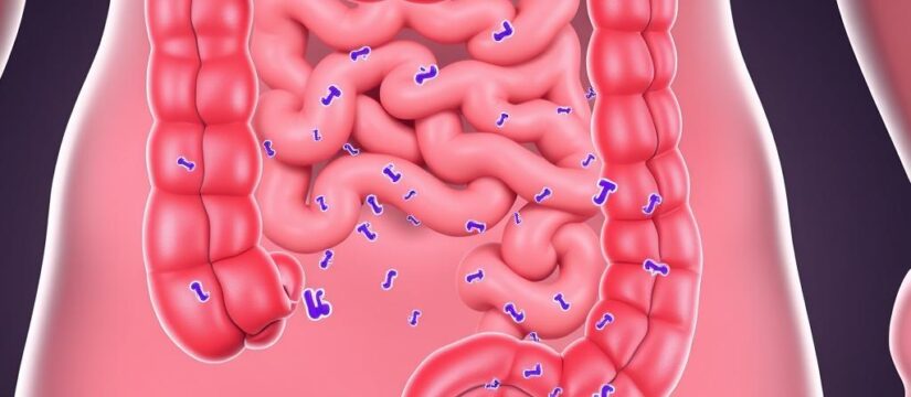 Gum Disease Bacteria May Drive Aggressive Colon Cancer